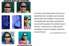 Apollo-drdo-dental-hyderabad-surgery