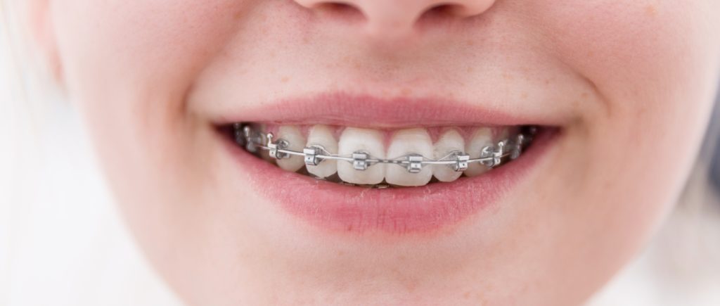Orthodontic Dentiatry